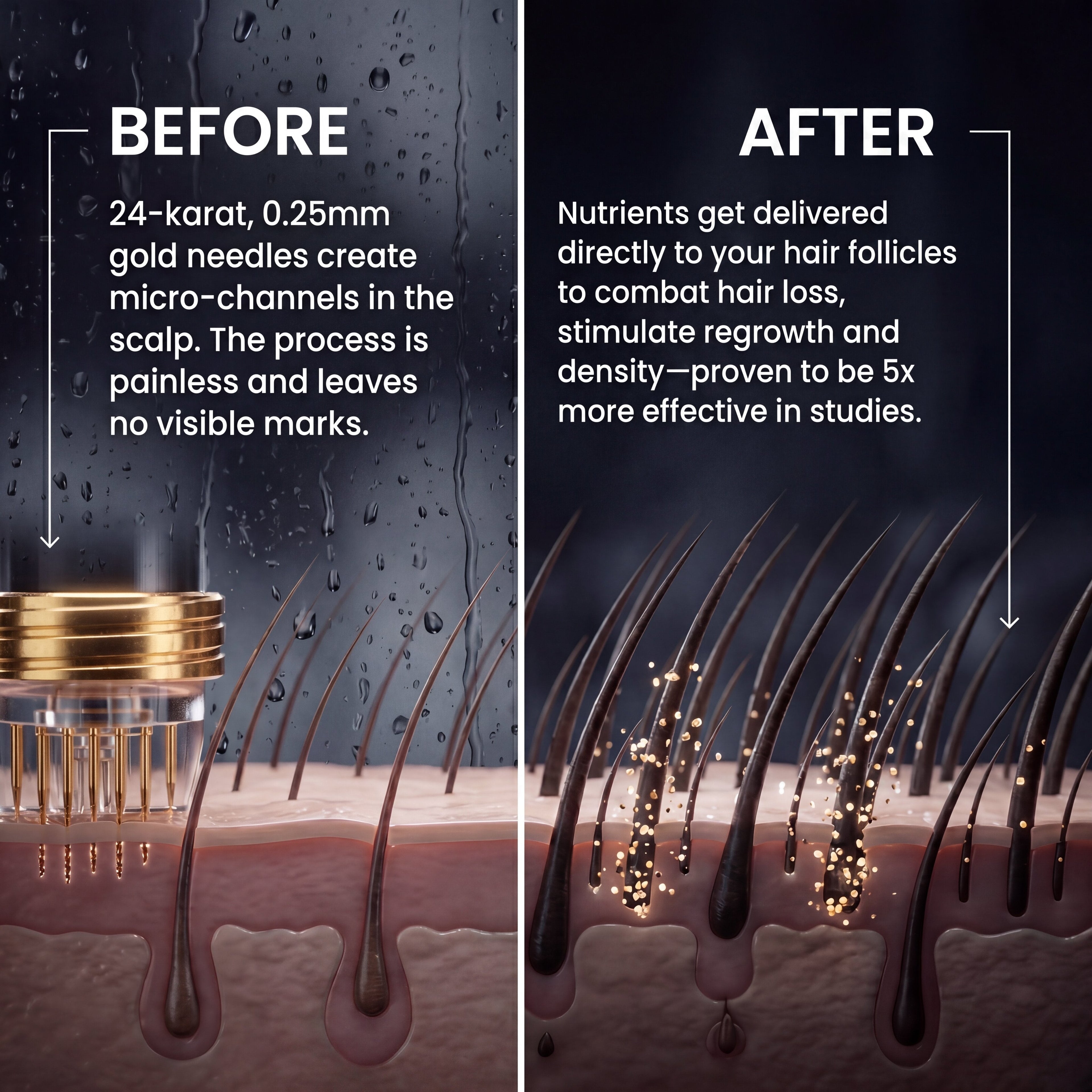 Microneedling Essence